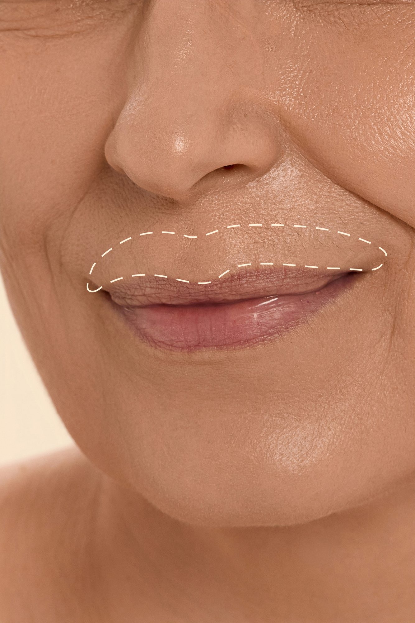Upper Lip