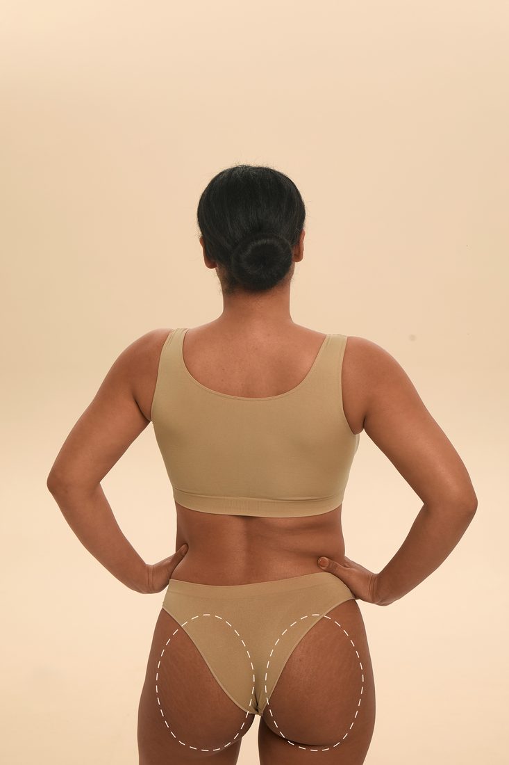 Buttocks