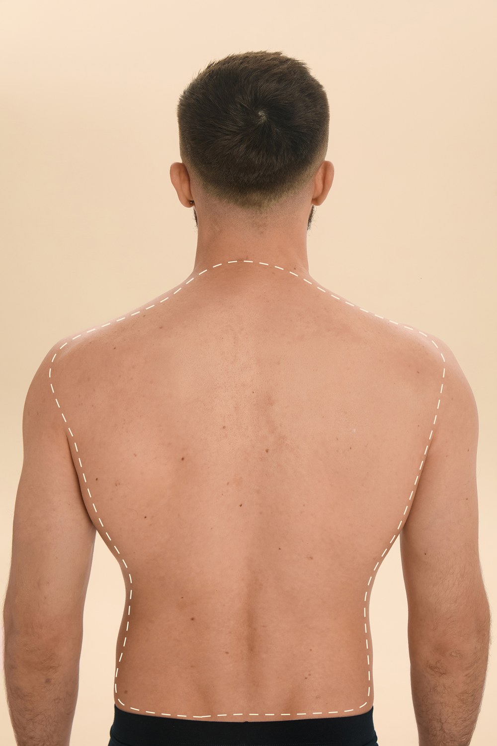 Full Back