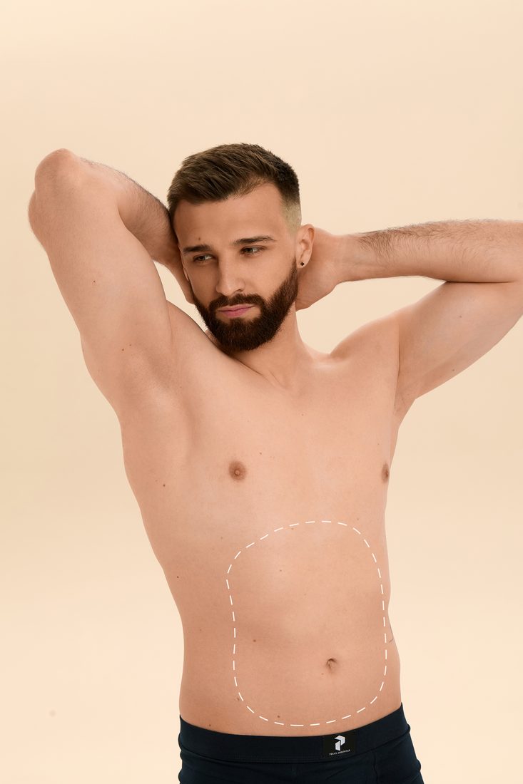 Abdomen