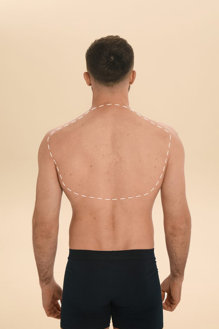 Upper Back