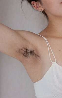 Unwanted body hair