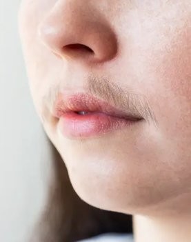 Facial hair