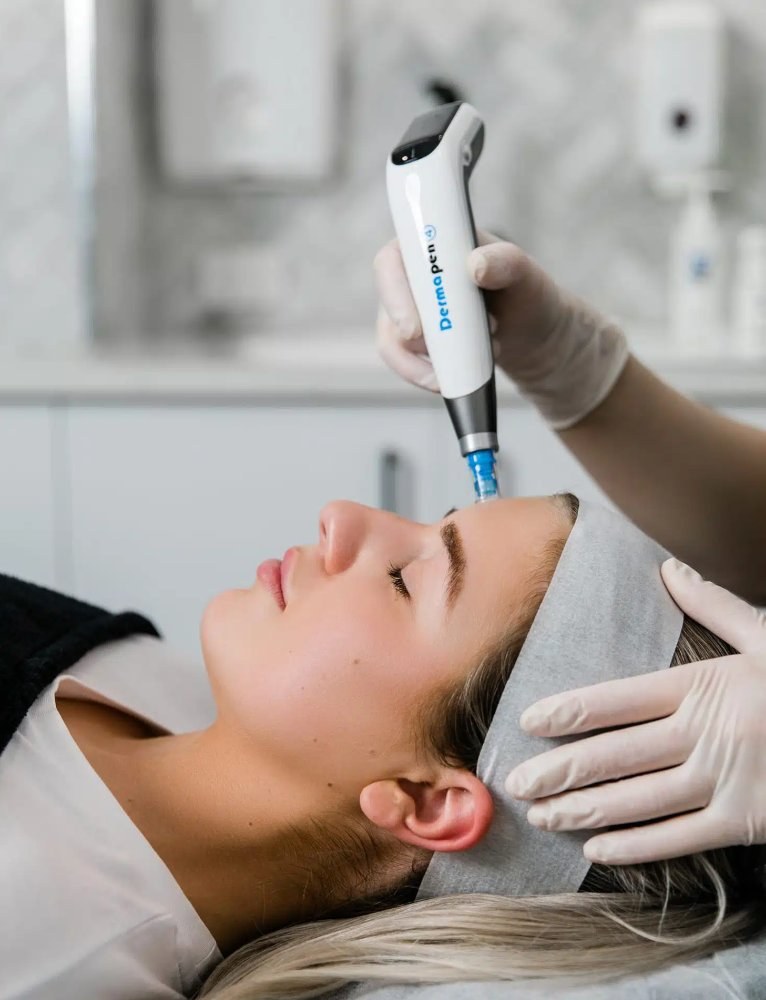 Microneedling