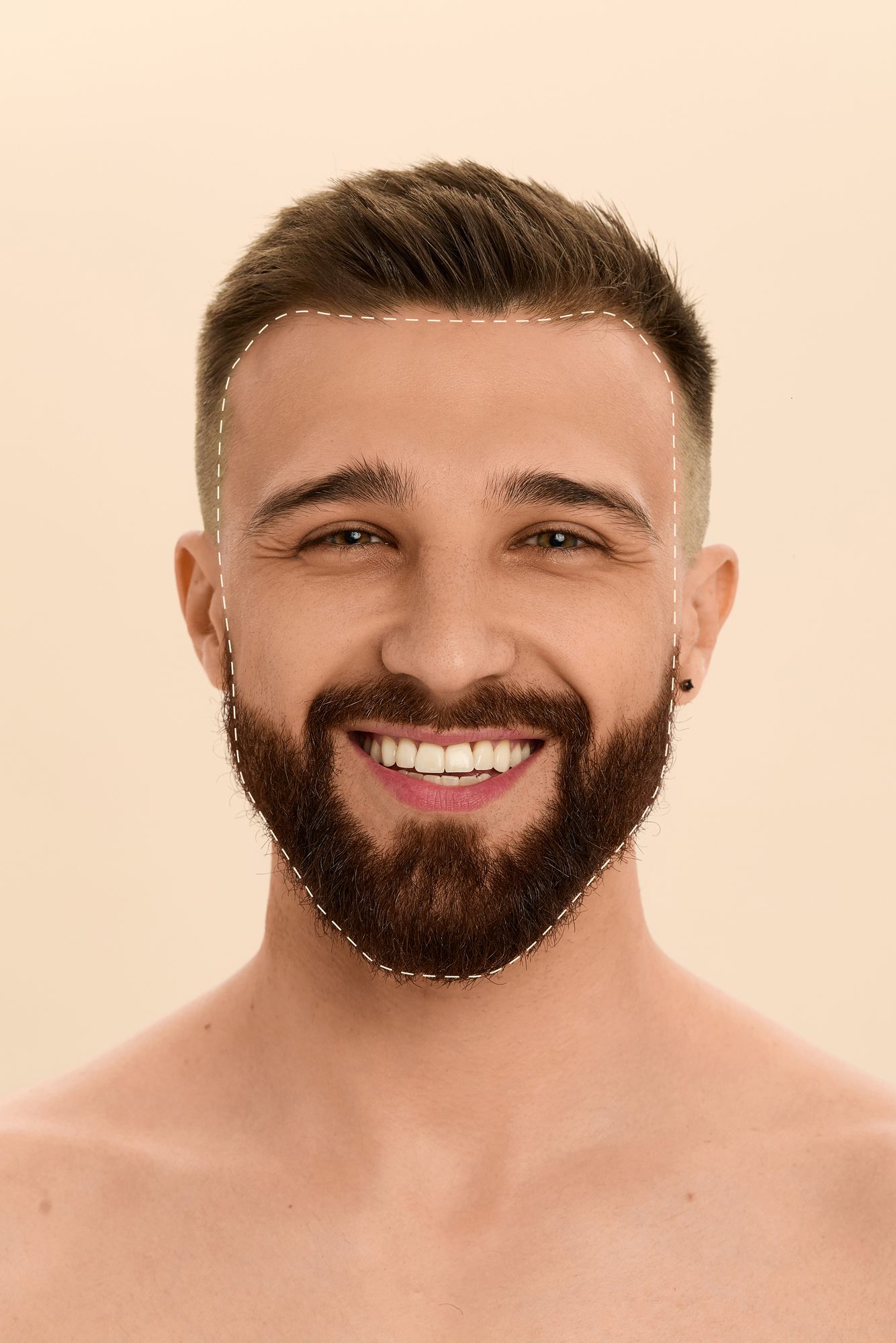 Upper Lip + Chin + Sideburns laser hair removal bundle